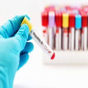 Xét-nghiệm các chỉ số viêm gan B