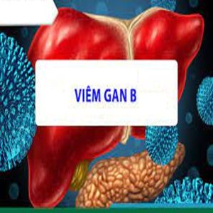 Viêm-gan-virus-B-hbv-là-gì