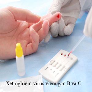 Xét-nghiệm-virus-viêm-gan-B-và-viêm-gan-C